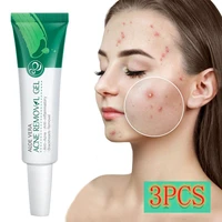 3pcs natural aloe acne treatment gel cream moisturizing anti acne removal scar pimple oil control whitening face serum skin care