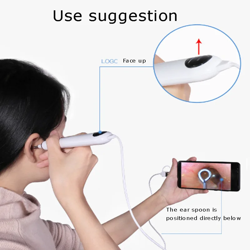 Ушной эндоскоп Видимый ушной ковш Otolaryngoscope наушник артефакт|Обрабатывающий