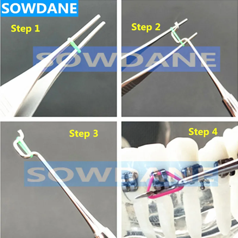 Стоматологический ортодонтический вихревой модуль инструмент для размещения