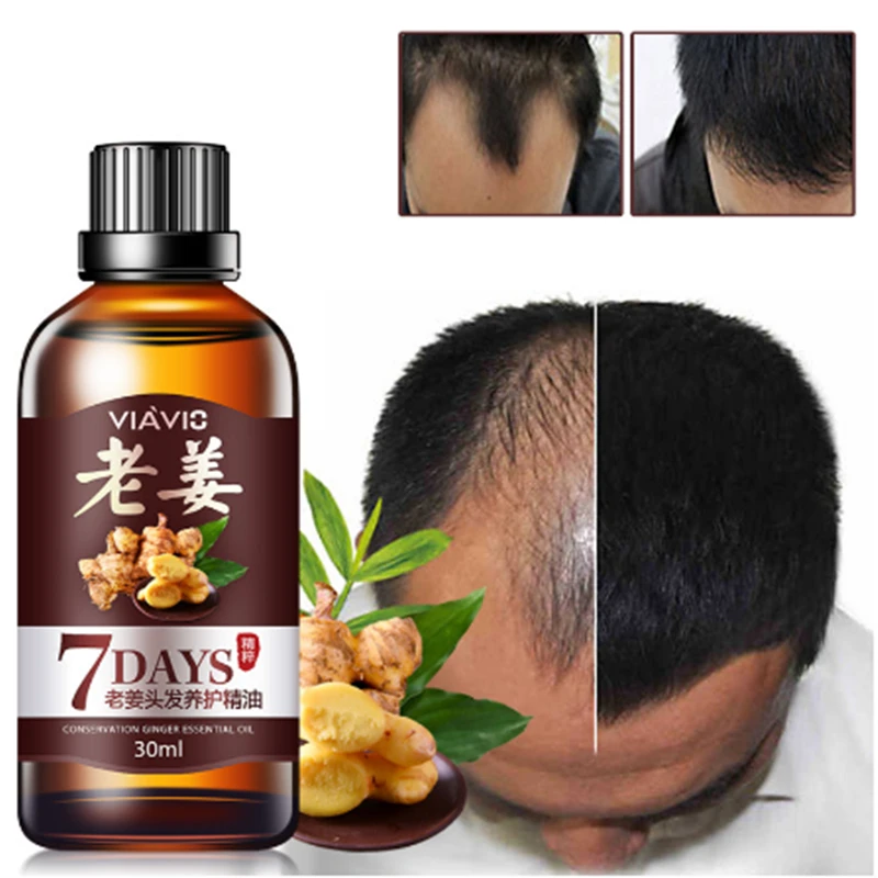 Новый 30 мл 7 день ускоренный рост волос эфирное масло эффективное лечение