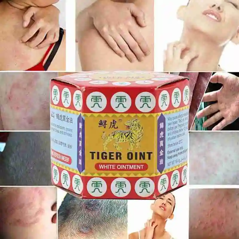 

Summer Cooling oil Chinese Tiger Balm Red Refresh Oneself Headache Oil Of Treatment Cold Essential Influenza Relax E7D620pcs