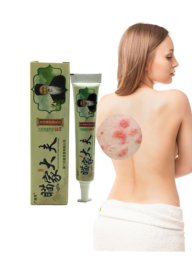 Psoriasi Eczma крем спрей Хорошо работает против проблем с кожей|cream for skin|cream psoriasiscream