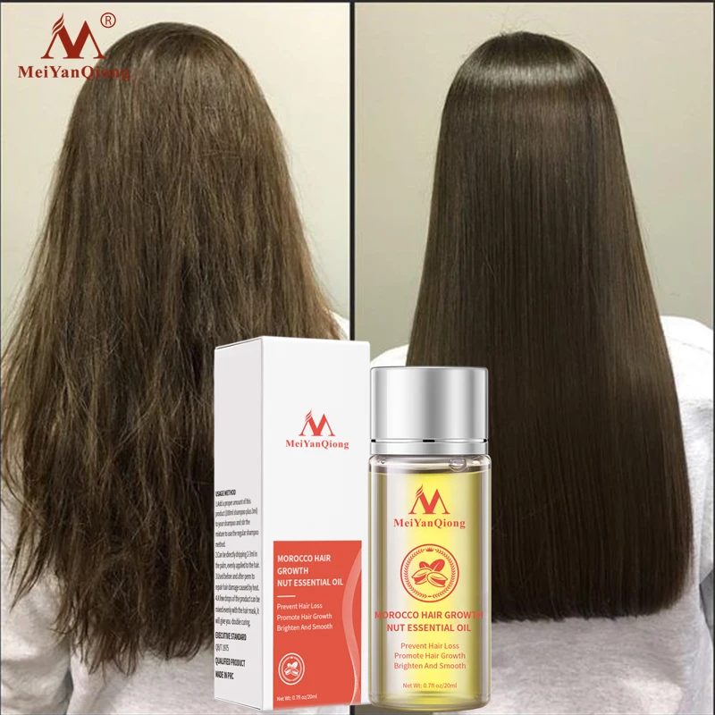 

Moroccan Fast Hair Growth Essence Oil Nut Nourishing Hair Root Repair Damage Hair-Growth Treatment Hair Loss Soften Scalp Care