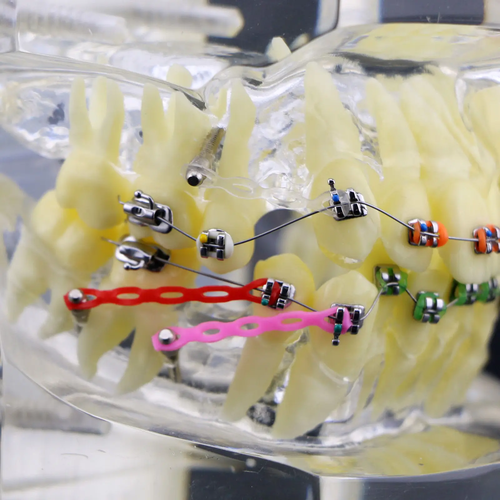 1 шт. Ортодонтическая зубная терапия модель прикуса с цепной проволокой #3005