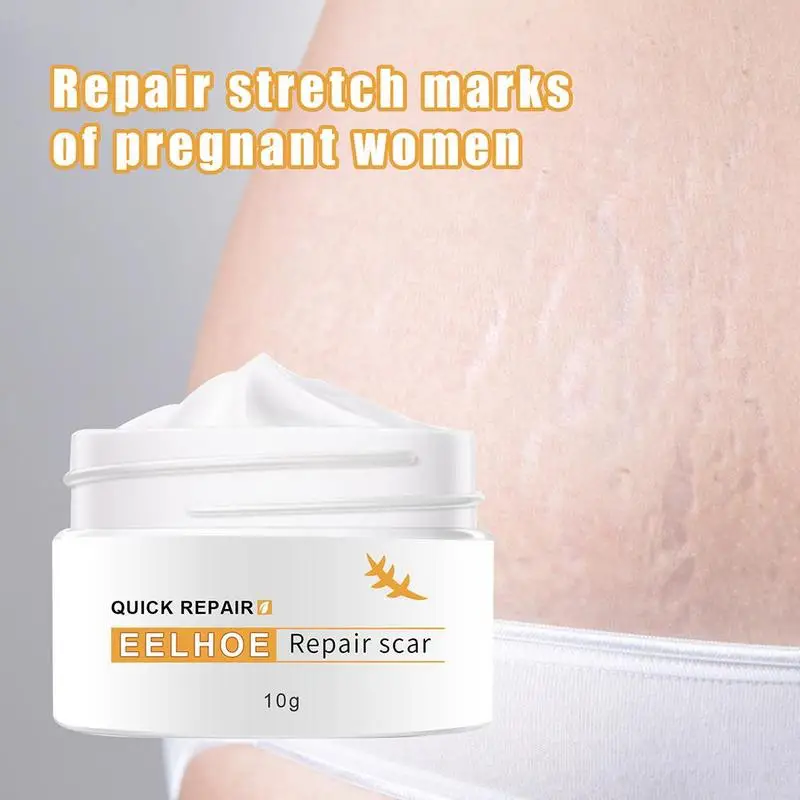 New Acne Scar Removal Cream Face Pimples Maternity Stretch Marks Repair Gel body Smoothing Whitening Moisturizing Skin Care 30g