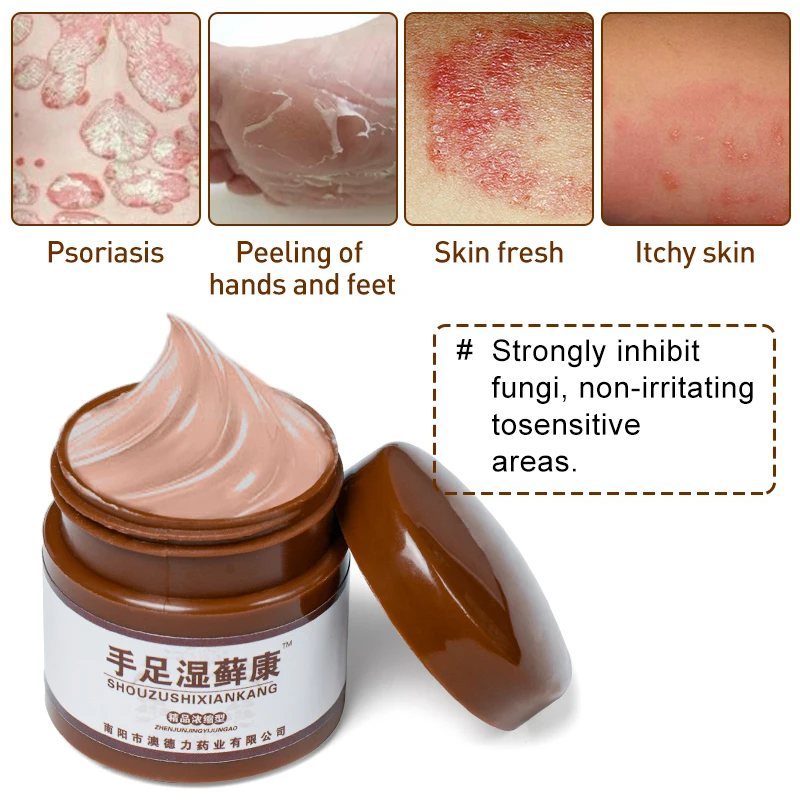 1 шт. мазь от псориаза экзмы антибактериальная грибкового червя дерматита экземы