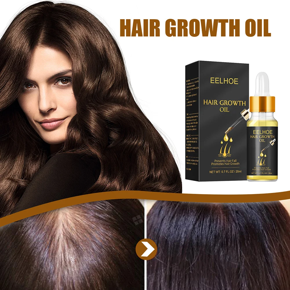 

Hair Care Hair Growth Essential Oil Prevent Hair Loss Repair Damaged Hair Dense Hair Growth Oil Hair Care for Women and Men