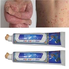 мазь лечения псориаз аллергии кожи дерматит баланит зуд псориаза экзема восстановления кожи крем для тела мазь от псориаза и экземы POLYSMBETY крем от псориаза ремонт кузова крем для тела Низкая цена