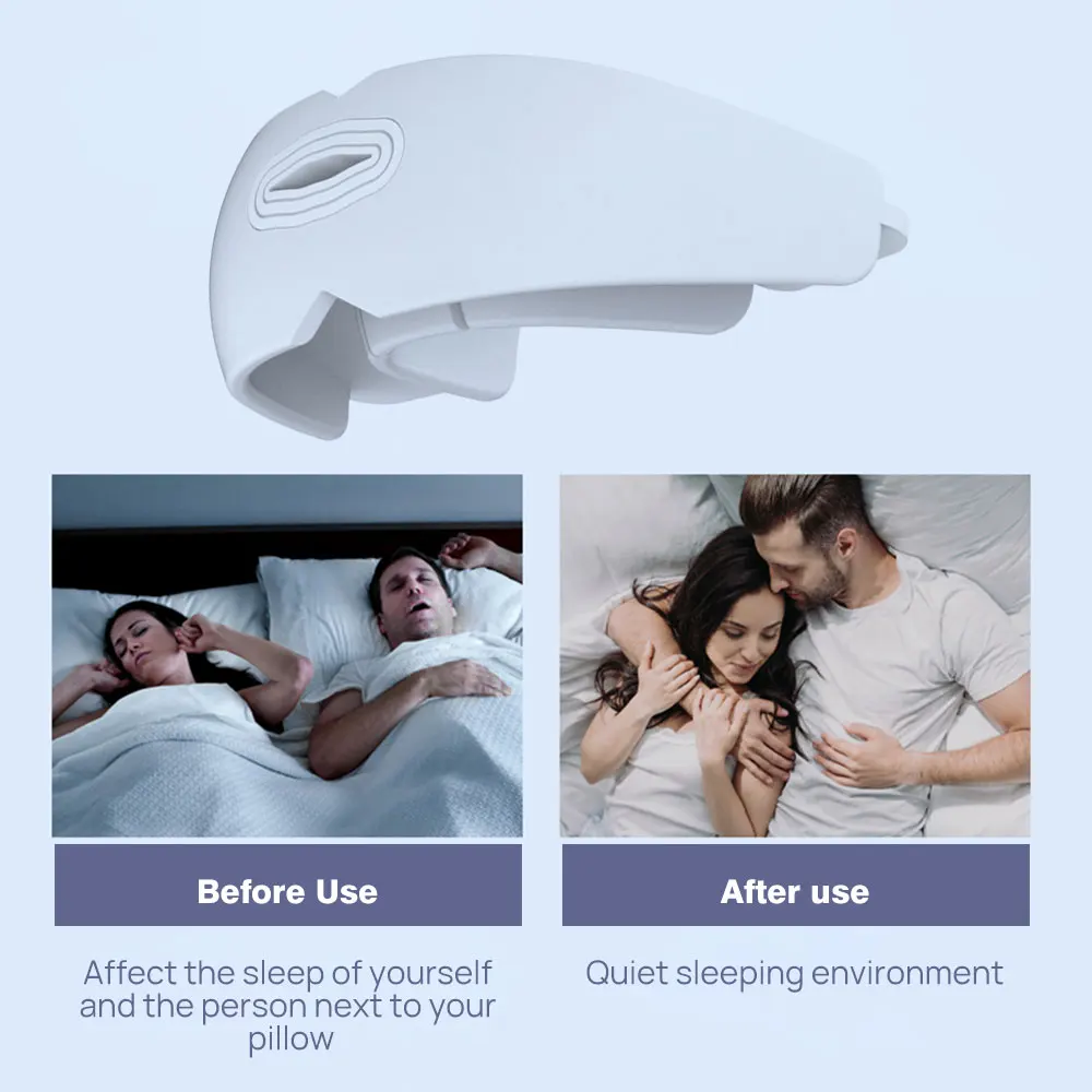 

Anti-molar Anti-snoring Brace Office Bedroom Physical Therapy Sleeping Brace Physical Occlusion Training Beautification Teeth