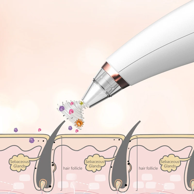 Вакуумный инструмент для удаления черных точек прыщей в носу | Красота и здоровье