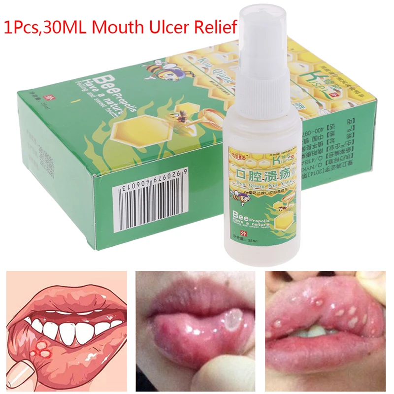 

Спрей для очистки полости рта, с прополисом, язва полости рта, от фарингита, боли в горле, 30 мл, 1 шт.
