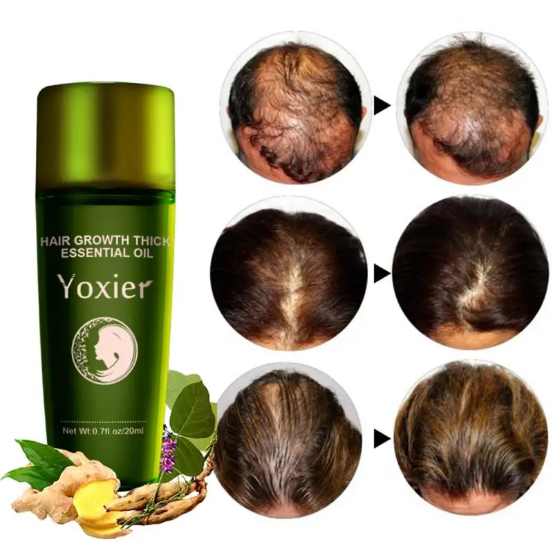 

Yoxier 20ml Hair Growth Oil Fast Grow Hair Oil Hair Loss For Thinning Hair Products Plant Oil Hair Care For Men Women TSLM1