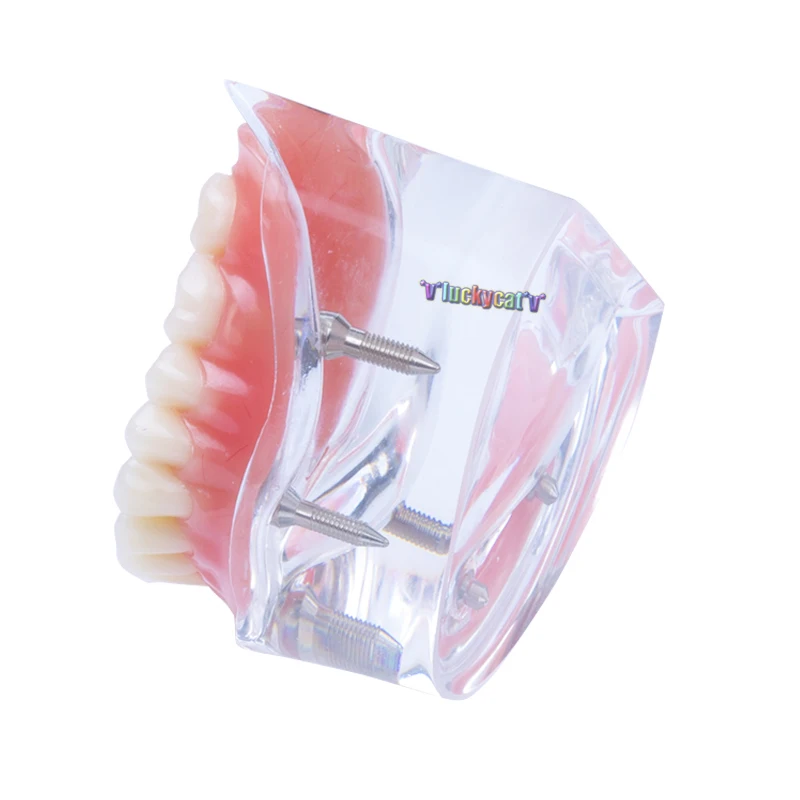 Модель зубного протеза съемная внутренняя модель нижних зубов Mandibular с