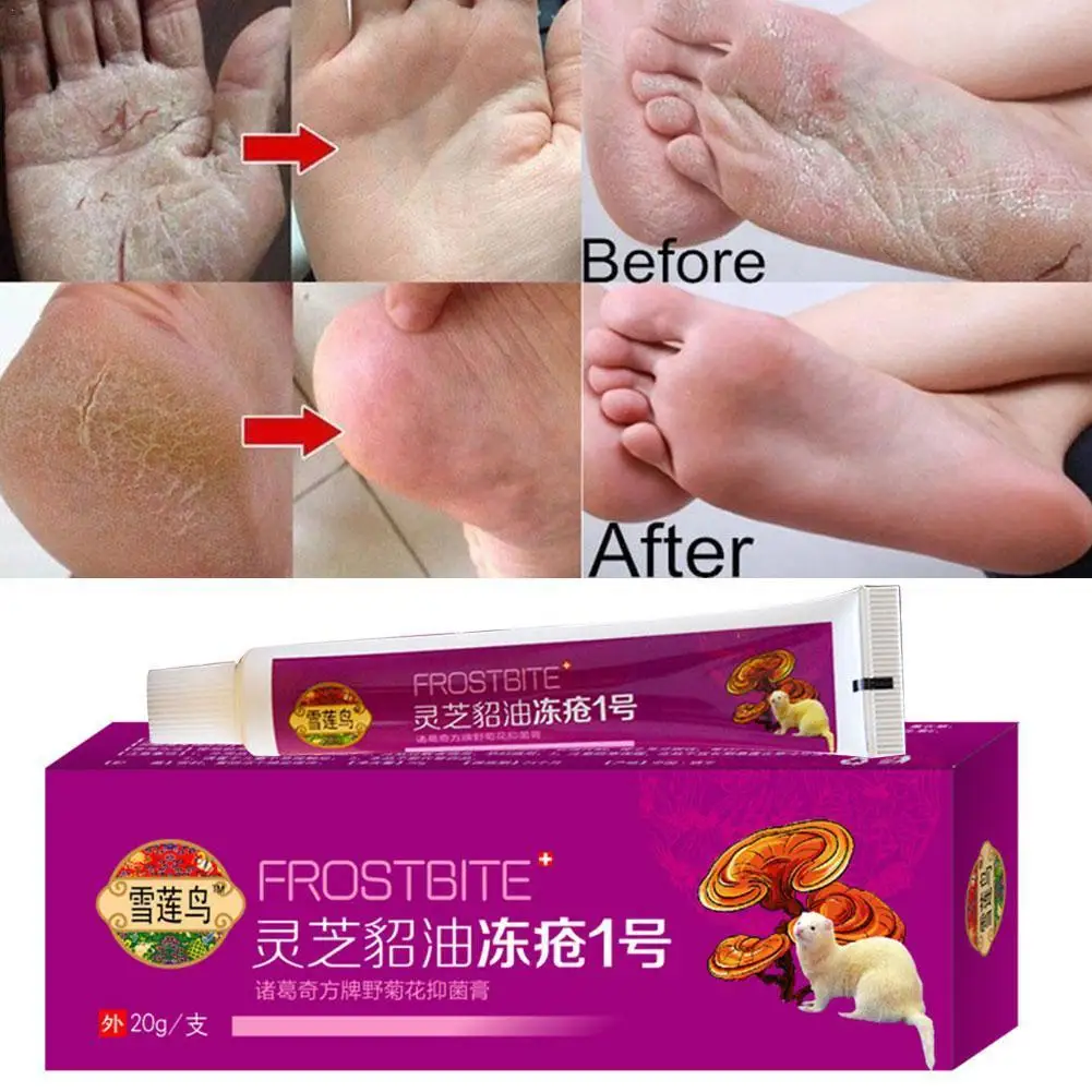 

1PCS Chilblain Cream Prevent Hand Foot Frostbite Cracked Ointment Moisturizer Oil Relief Itchy Repair Body Winter V9P9