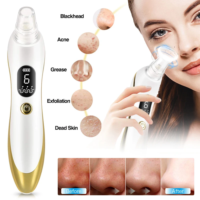 Очиститель для удаления угрей со светодиодным экраном и порами вакуумный