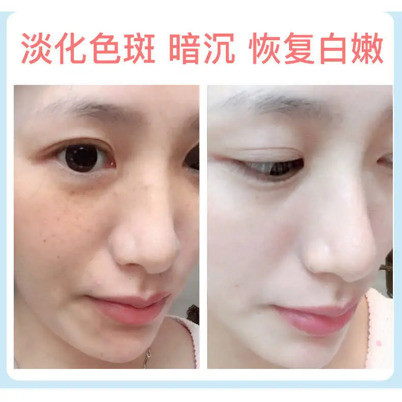 BINGJU увлажненитель с гиалуроновой кислотой набор лосьона для воды Студенческая