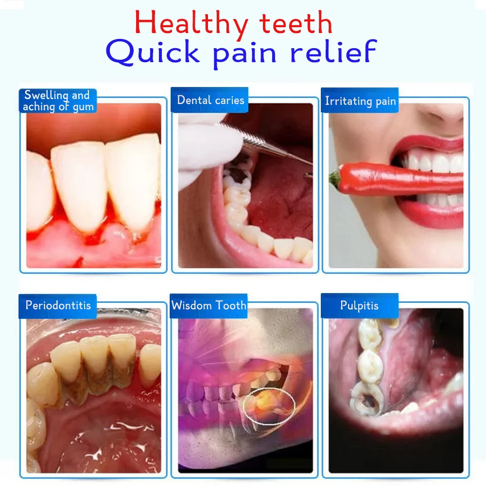 Спрей для быстрого лечения зубов эффективный с ватными палочками |
