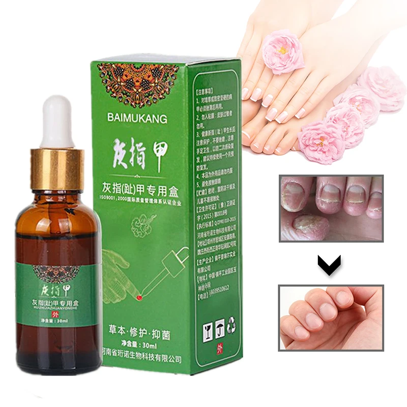 

Onychomycosis Nail Repair Promote Regrow Nail Care Nail Essence Anti Infection Paronychia Leuconychia Toe Nails Removal Gel