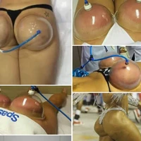 breast buttocks enhancement pump lifting vacuum cupping suction therapy device natural physical enlargement hijama suction cup