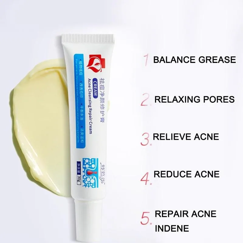 30g Acne Treatment Face Cream Blackhead Repair Gel Cream Acne Removal Whitening Skin Shrink Care Pores Scar Z6J3