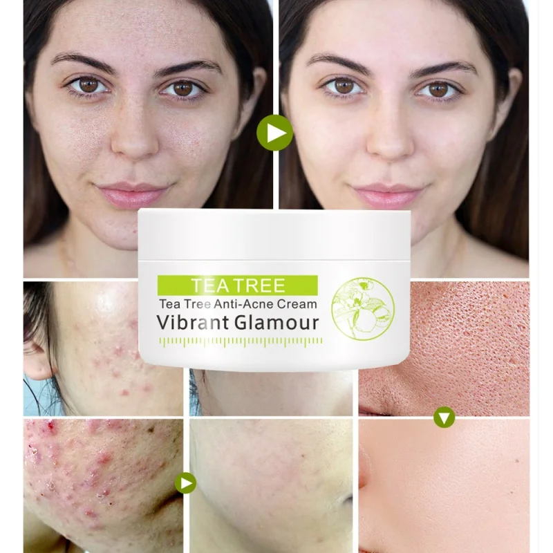 Новый чай дерево крем против акне лечение отбеливающий уход за кожей лица маска