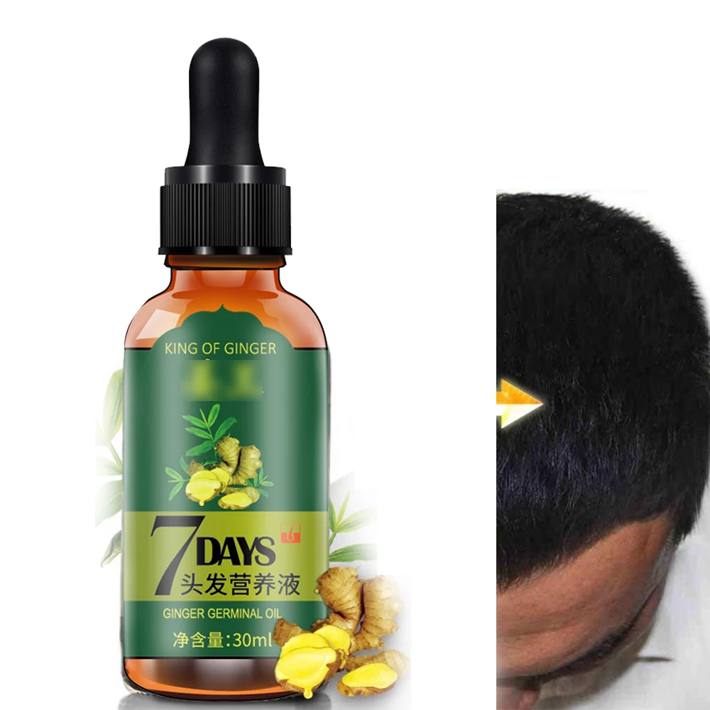 

Hair Growth Essential Oils Ginger Germinal Oil Fast Hair Growth Anti-Hair Loss Alopecia Treatment Beauty Dense Hair Growth Serum