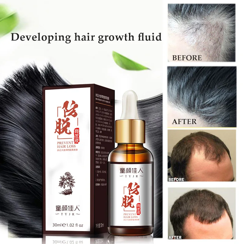 30 мл средство против выпадения волос быстрое для эссенция масло натуральные