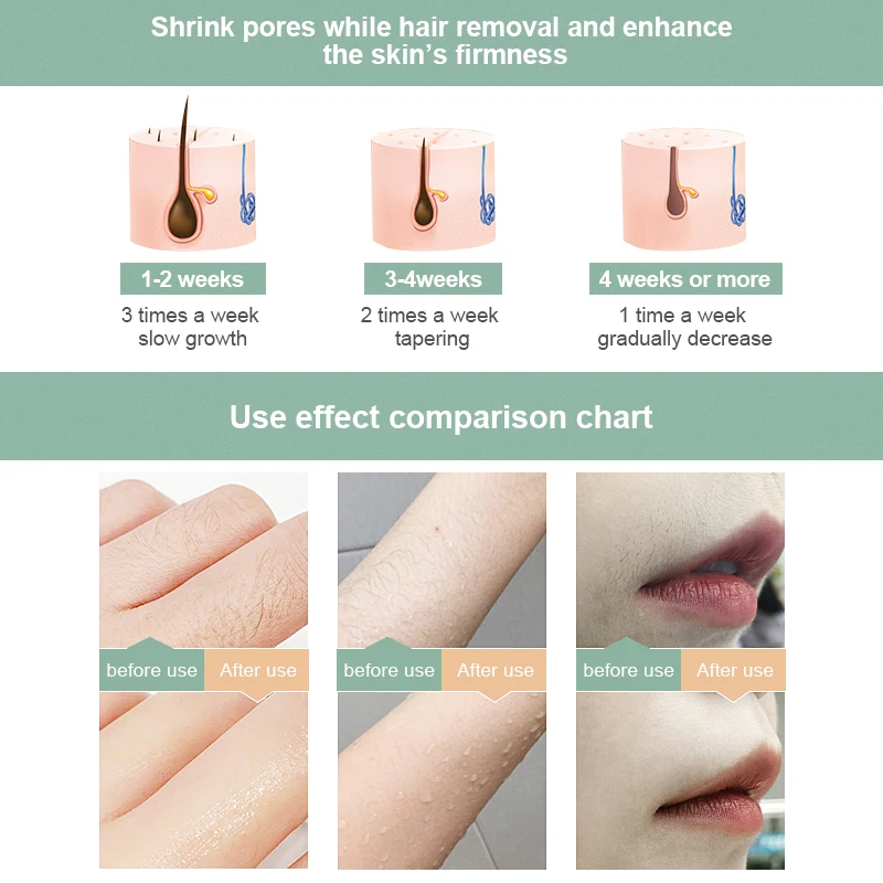 

Professional Permanent IPL Hair Removal Laser Epilator For Women 999999 Flash Electric Photo Painless Hair Removal Machine