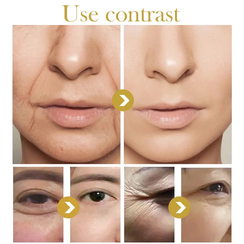 LANBENA Anti Wrinkle Face Cream Aging Nourishing Day Hyaluronic Acid Whitening Moisturizers serum Skin Care |