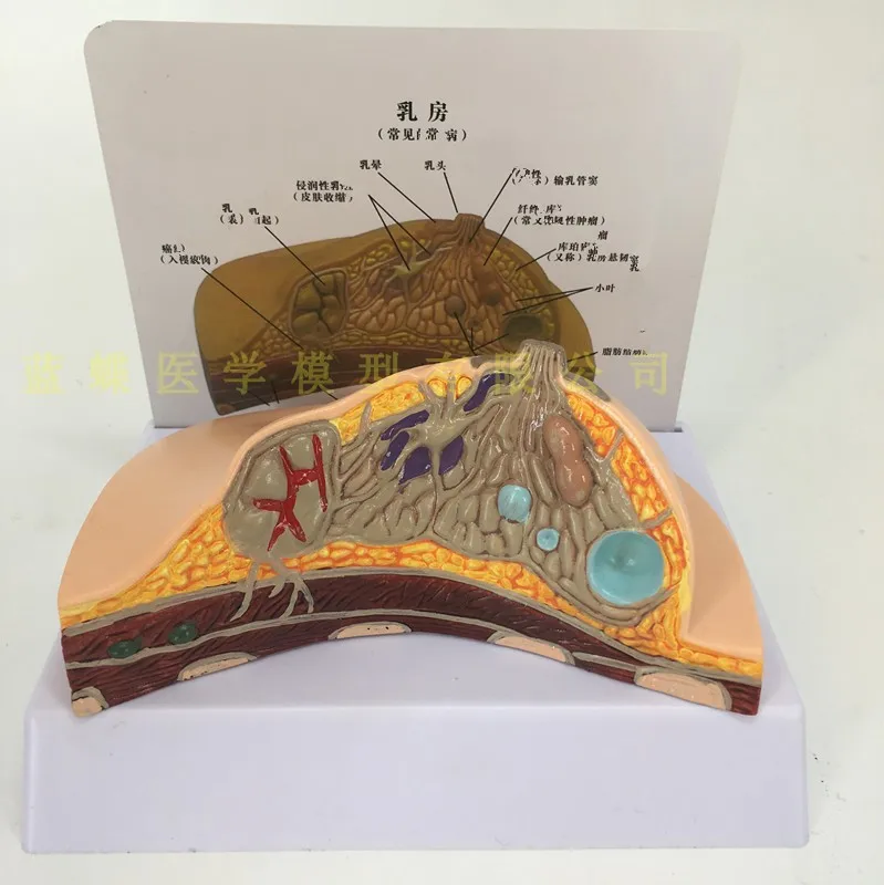 Breast disease Anatomy model Human Body Model ill/normal /lactation period free shipping | Medical Science