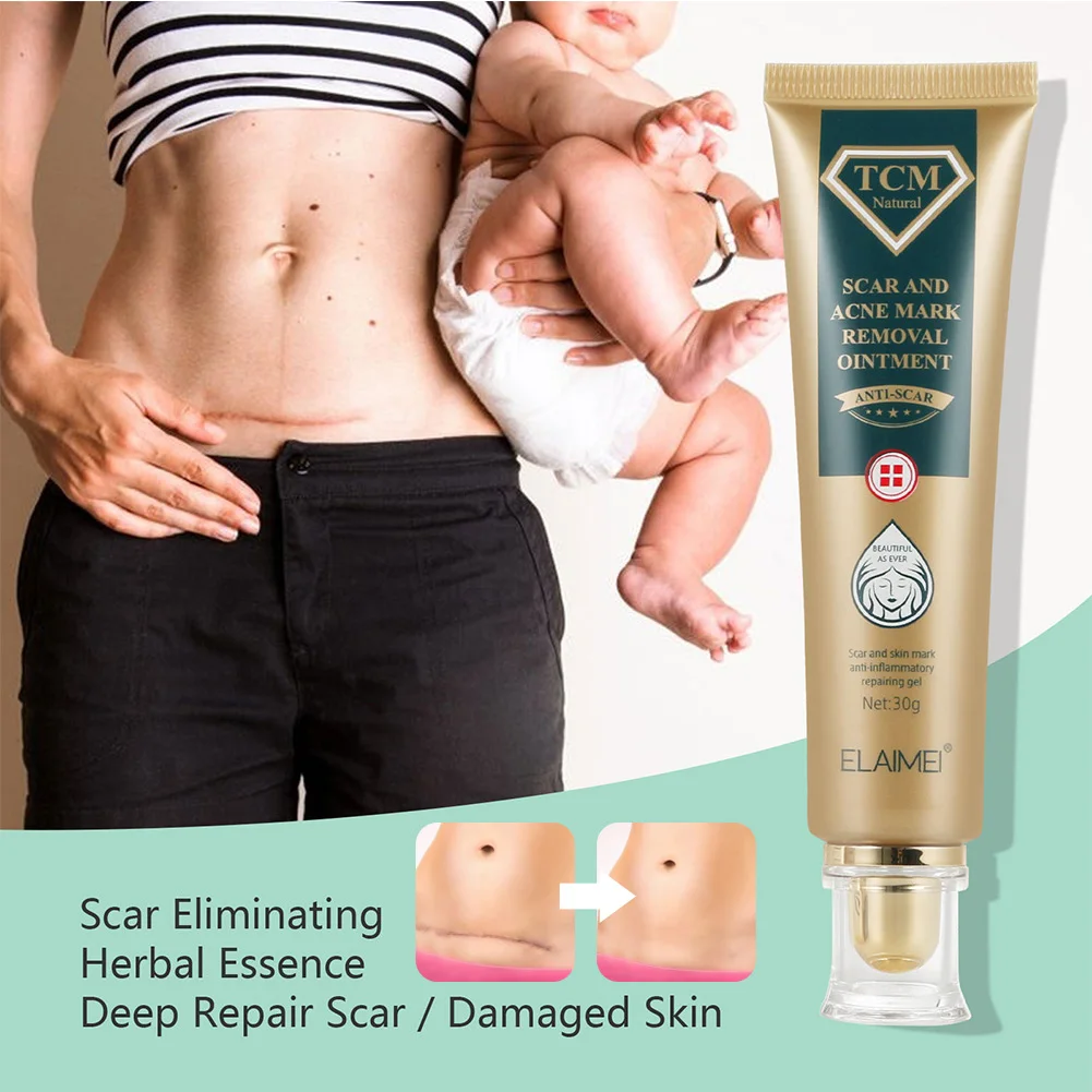 

Acne and Scar Treatment Gel Safe Natural Plant Extracts Acne Scar Dark Spots Removal Gel Smooth and Brighten Skin