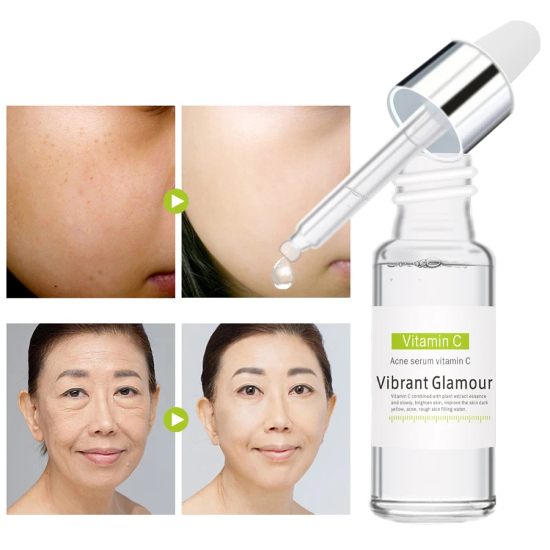 15 мл эфирное масло для лечения прыщей уход за кожей лица витамин С отбеливание