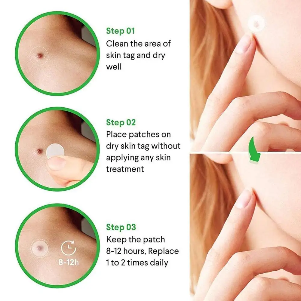 

Genital Wart Treatment Papillomas Removal of Warts Removal Tags Moles Remover From Wart Liquid Removing liuld Against Skin M7S4