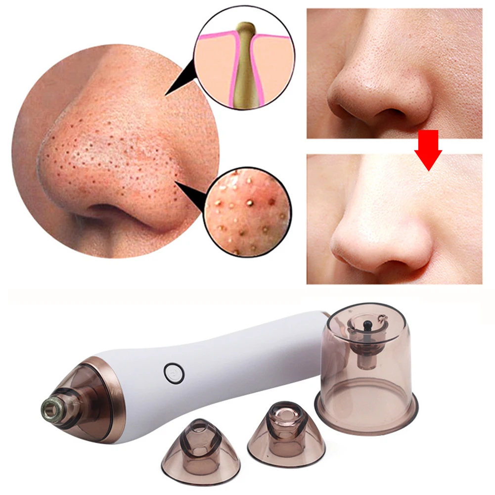 

Pimples Home Cupping Cleaner Skin Care 4 Modes Electric Blackhead Remover Vacuum Suction USB Rechargeable Handheld Comedone Nose