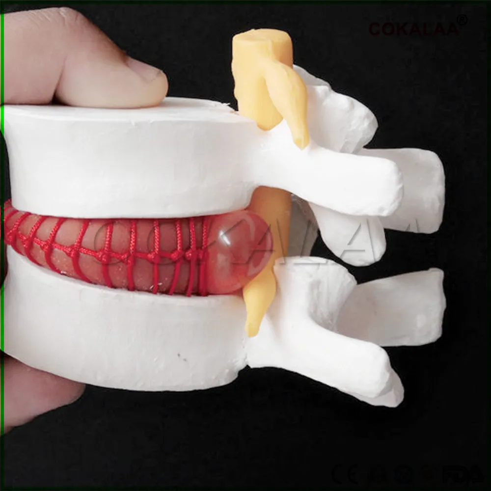Человека анатомический Скелет спина поясница грыжа диска Учебная модель мозга