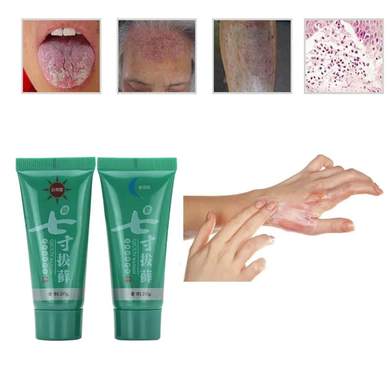 1 Набор дневной и ночной крем для тела от псориаза натуральная мазь псориаз экзма