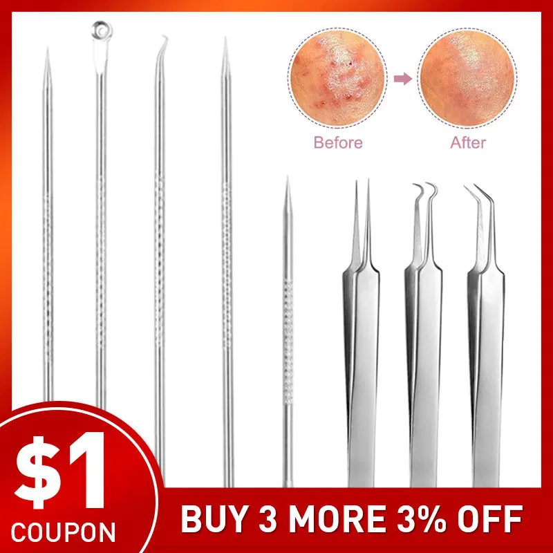 Пинцет Для Удаления чёрных точек и прыщей из нержавеющей стали| |