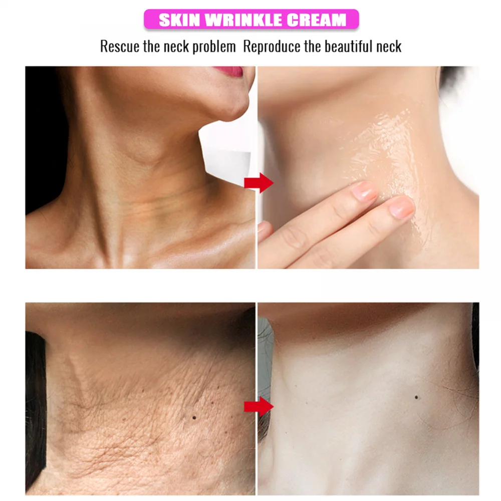Neck Firming Wrinkle Remover Cream Rejuvenation Skin Whitening Moisturizing Shape Beauty Care Products | Красота и здоровье