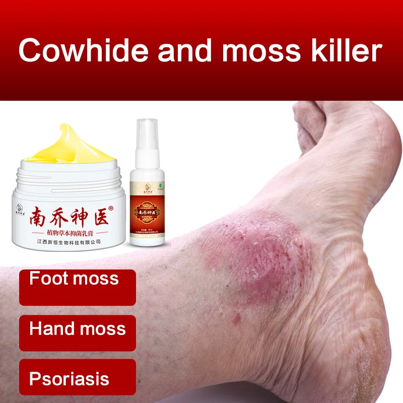 Крем для лечения псориаза дерматита экземы 30 г | Красота и здоровье