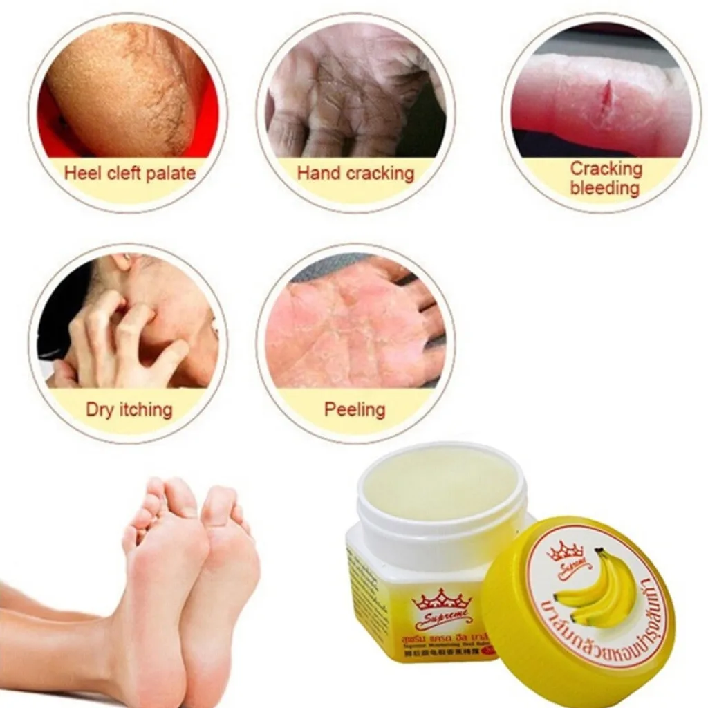 2019 Уход за ногами педикюр анти сушильный крем от трещин отмершей кожи удаления