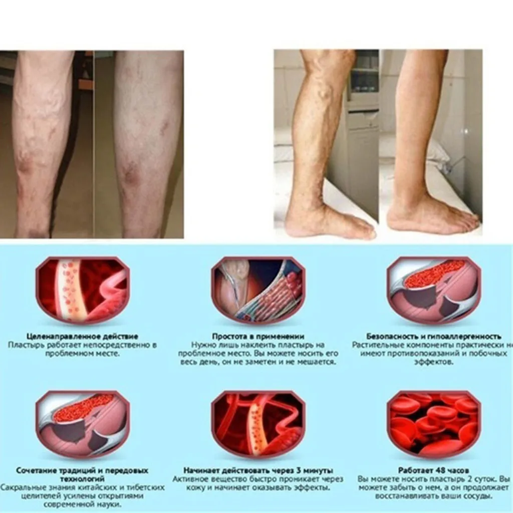 SAGACE модные унисекс компрессионные чулки гольфы поддерживающие растягивание