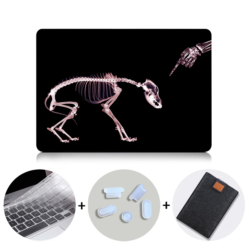Жесткий чехол MTT с черным каркасом для Apple Macbook Pro 13 15 retina для Mac Book Air 11 12 13 защитный чехол для ноутбука - Цвет: MB10