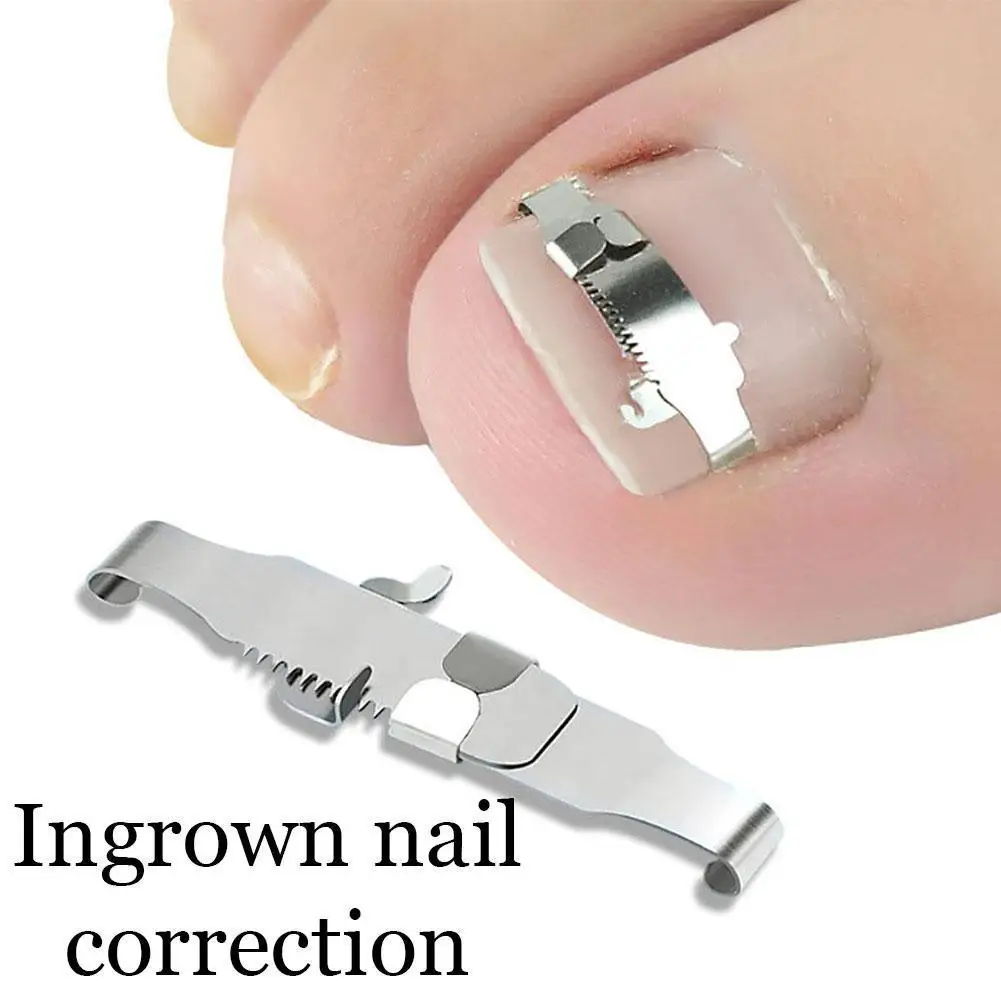 

1pair Ingrown Nail Correction Nail Fixer Embed Toenail Tool Pedicure Correction Lifter Recover Care Tool Pedicure Foot X3L1