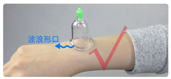 Бесплатная доставка набор изогнутых вакуумных банок с китайскими банками для