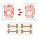 4 шт., пластырь для лечения вросших ногтей