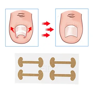 4 шт., пластырь для лечения вросших ногтей