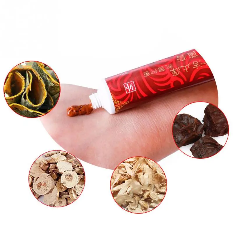 

Varicose Veins Treatment Cream Ointment Vasculitis Phlebitis Spider Veins Pain Varicosity Angiitis Remedy Removal Herbal Cream