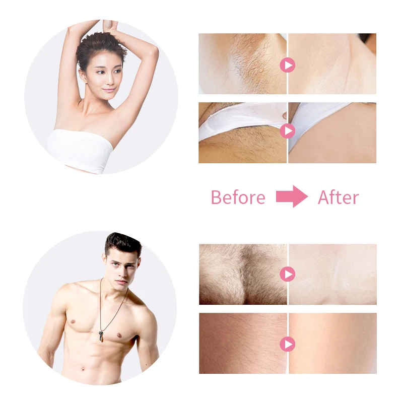 SaengQ женский Электрический лазерный эпилятор Перманентная Машинка для удаления