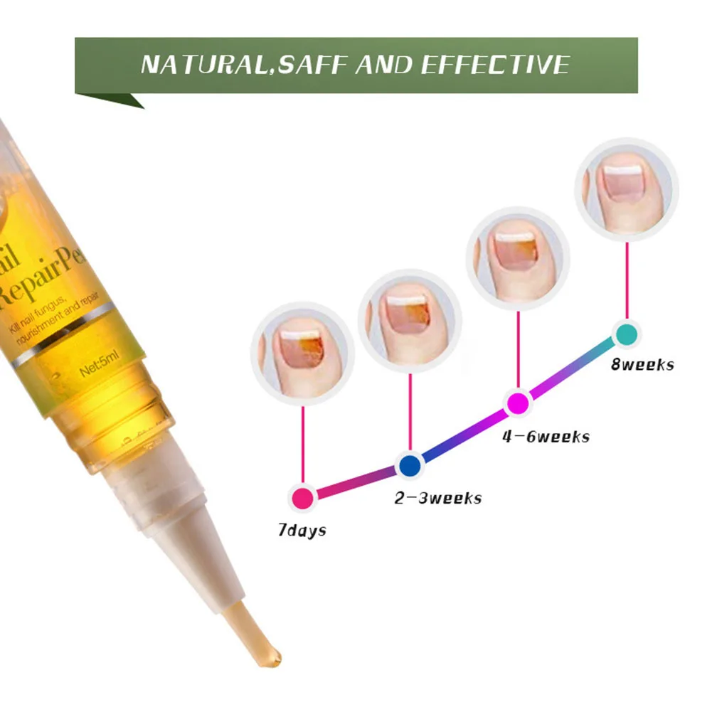 5 мл ручка для обработки ногтей жидкая кутикула восстанавливающее масло