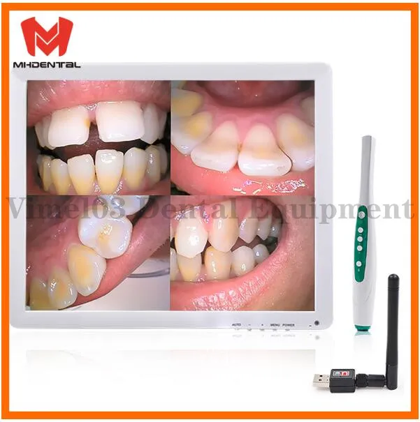 Новый 17 дюймов Беспроводной эндоскоп зубные мониторы и интраоральная камера